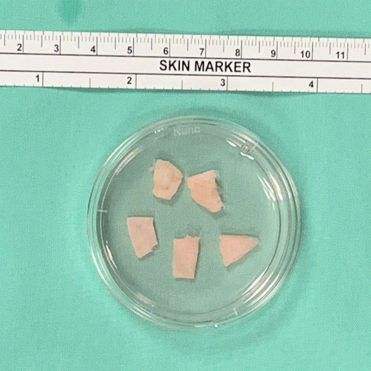 רקמות השחלה המופשרות לפני ההשתלה