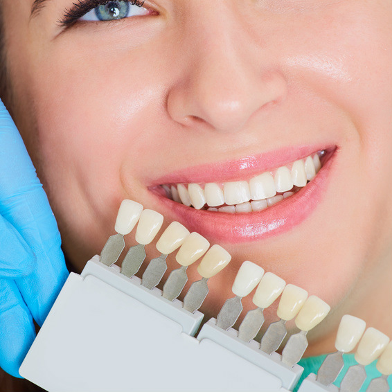 השתלות שיניים