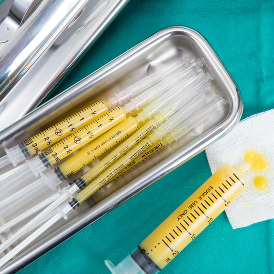 הזרקות שומן