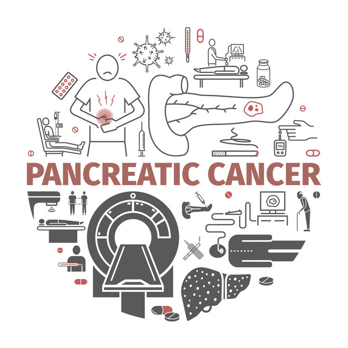 סרטן הלבלב