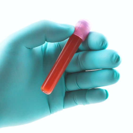 בדיקת דם