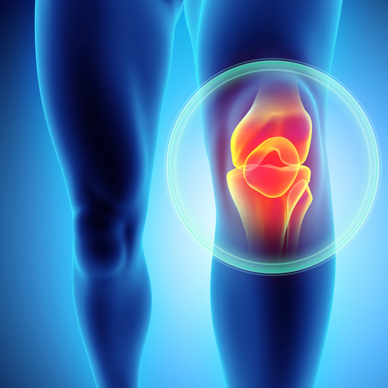 החלפת מפרק ברך