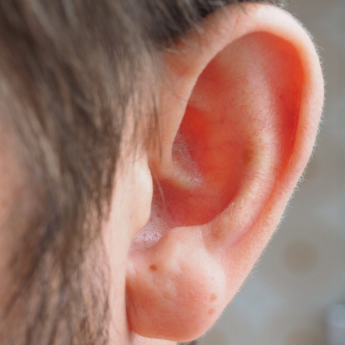 ניתוח כפתורים