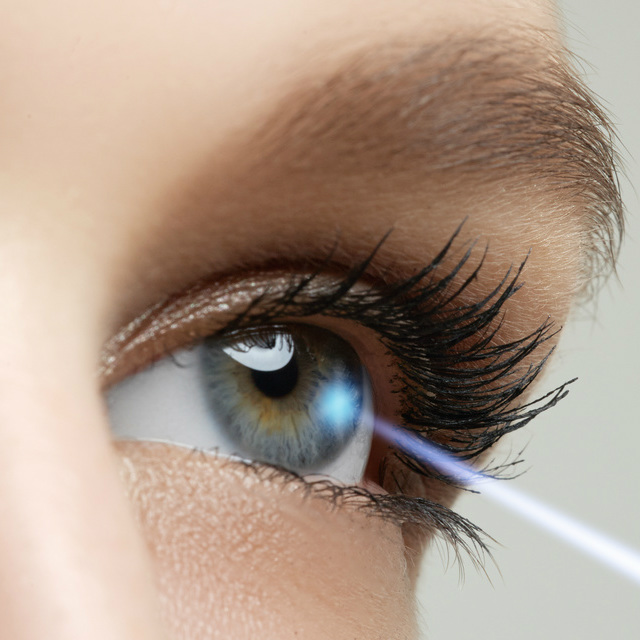 הסרת משקפיים בלייזר