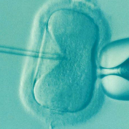 IVF