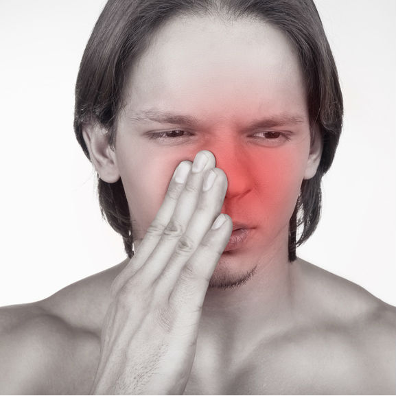 סינוסיטיס - אילוסטרציה