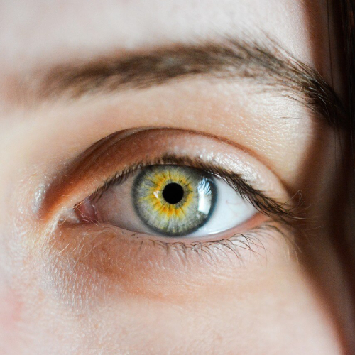 ניתוח עיניים