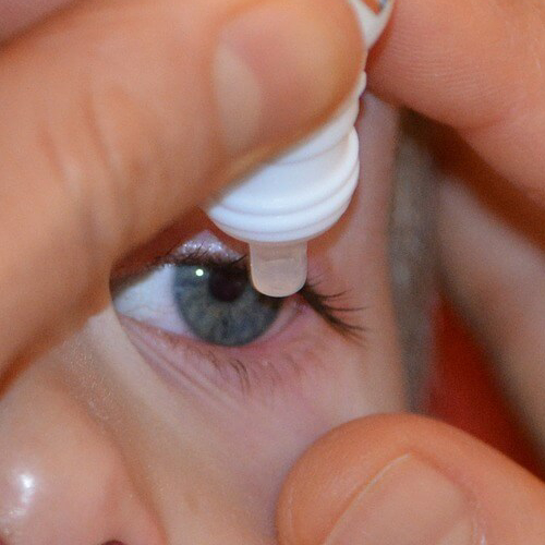 יובש בעיניים