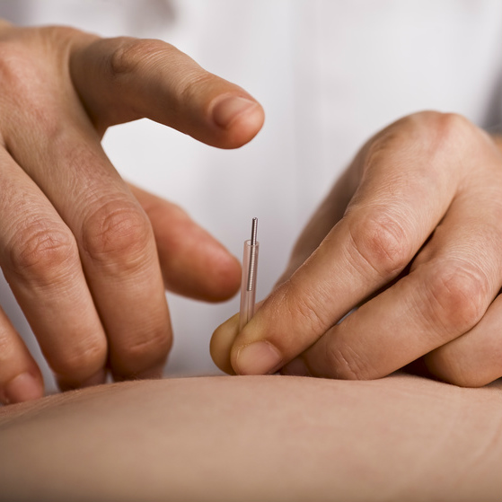 רפואה סינית