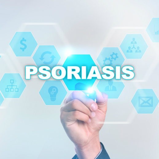 פסוריאזיס