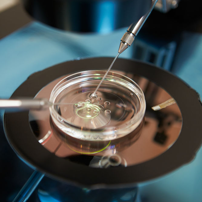 הפרייה חוץ גופית