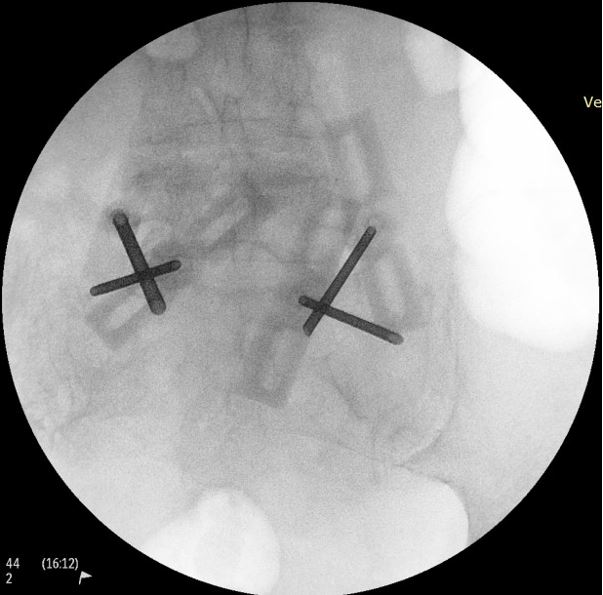 ההליך החדשני שפותח