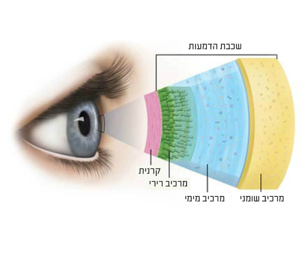איי-ויו המרכז ל עיניים יבשות
